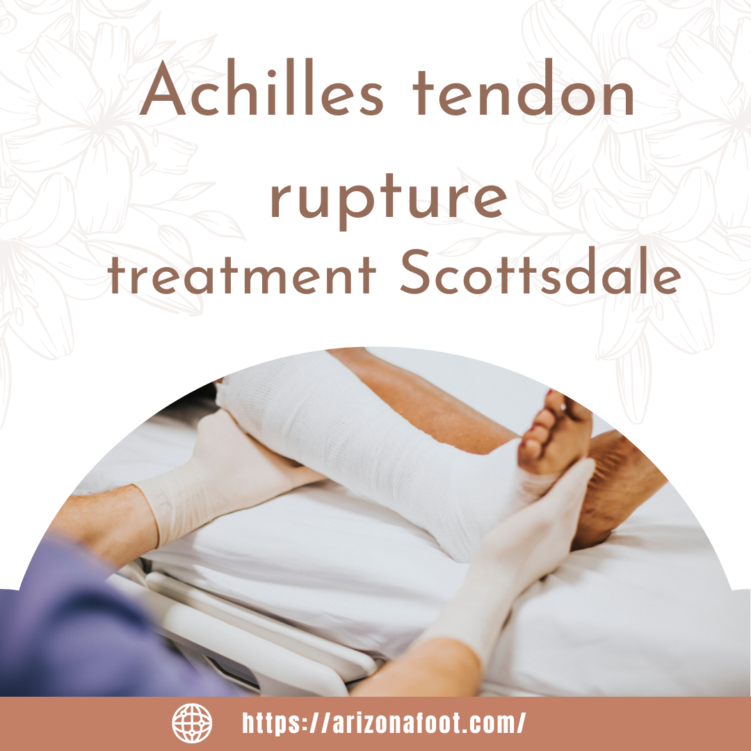 Achilles Tendon Rupture Treatment in Scottsdale: What You Need to Know