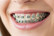 Your Guide to Advanced Orthodontic Care and Smile Correction
