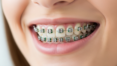 Your Guide to Advanced Orthodontic Care and Smile Correction