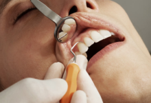Dental Implants vs Bridges: Which Tooth Replacement Is Better