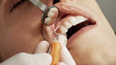 Dental Implants vs Bridges: Which Tooth Replacement Is Better